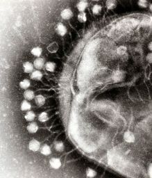 Electron Micrograph of Bacteriophages Attacking a Bacteria.... Ninja Style! Image sourced from Wiki Commons © GrahamColm